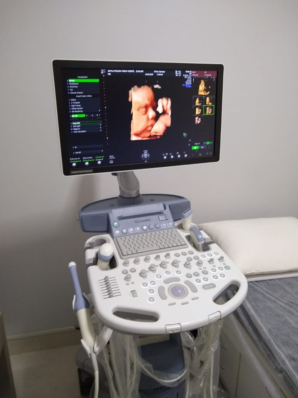 Foto equipamento de ultrassom